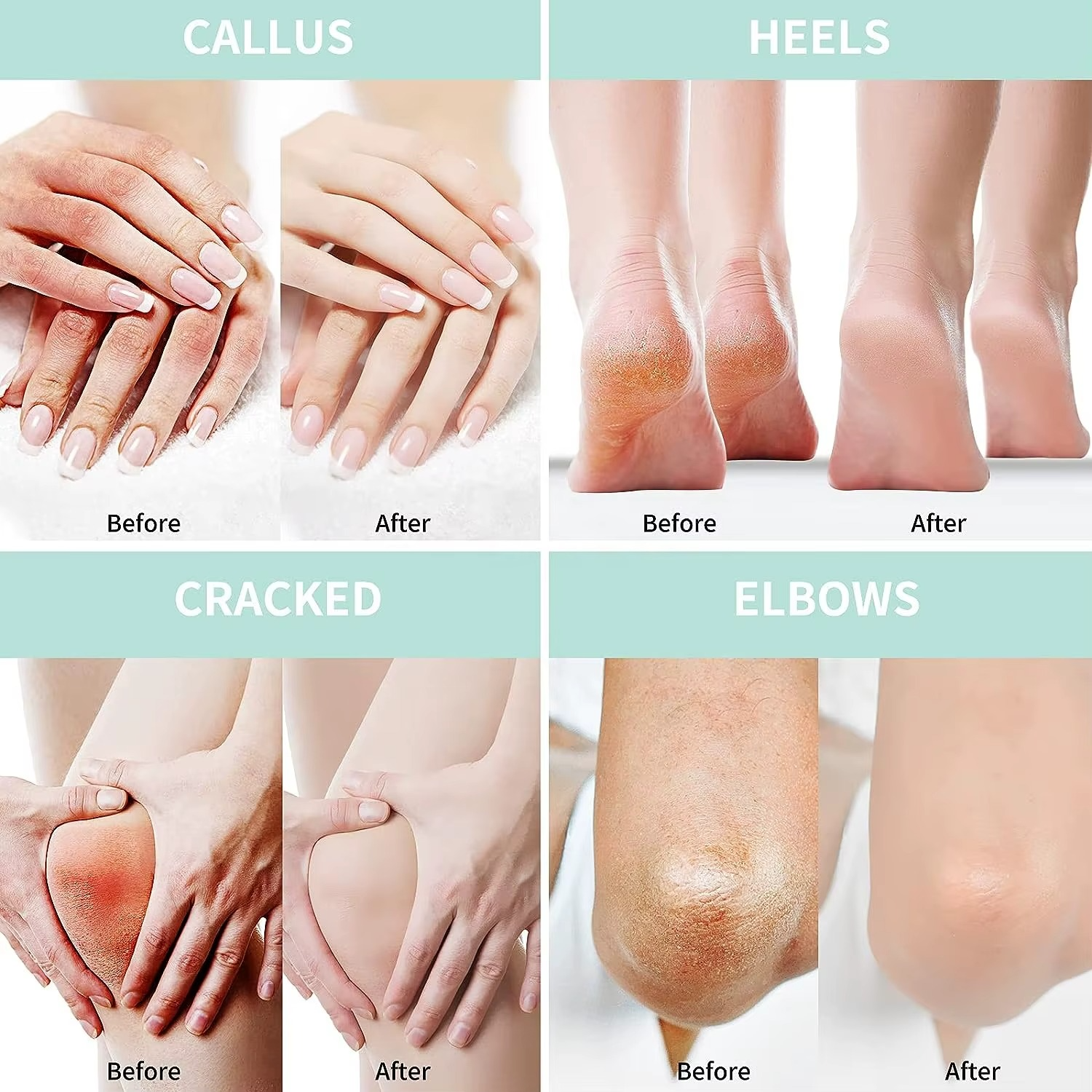 كريم مرطب ومغذي للعناية باليدين والقدمين بحمض الساليسيليك واليوريا - الصورة 7